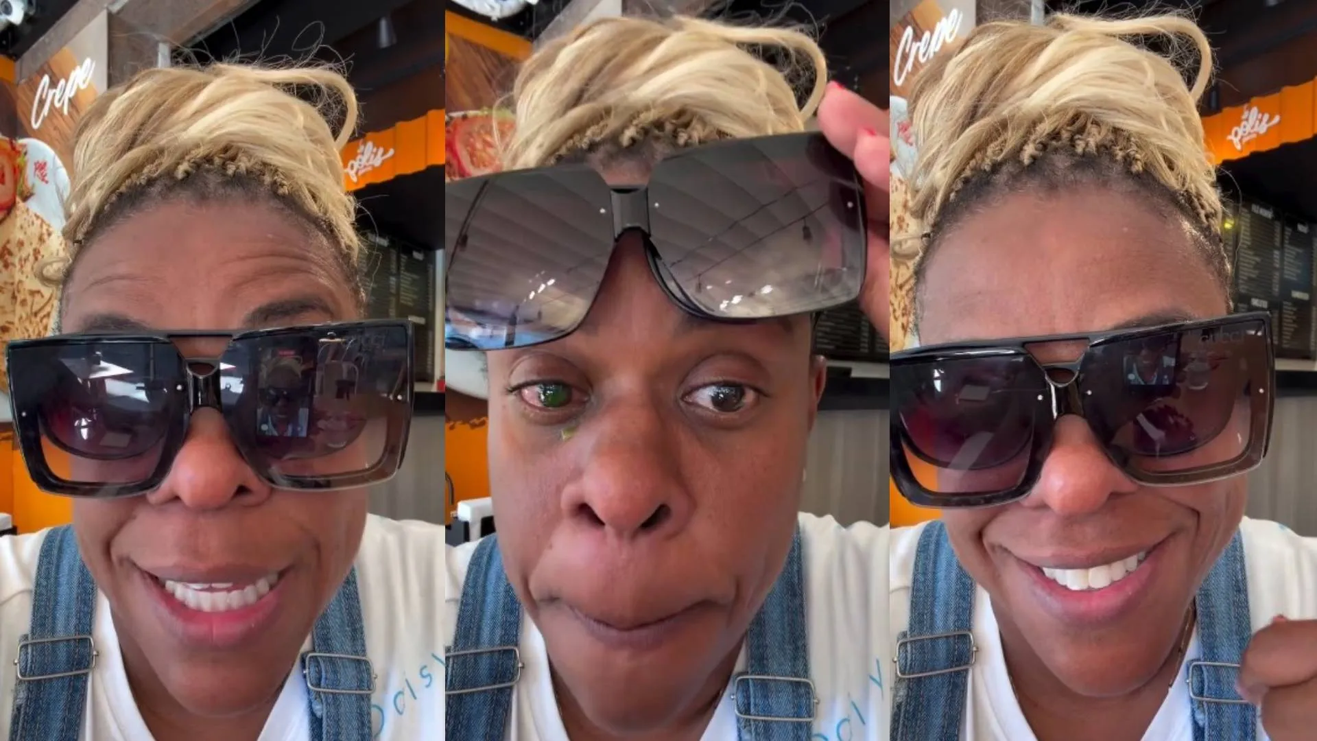 Olho vermelho e irritado de uma mulher, simbolizando reação alérgica a pomada capilar