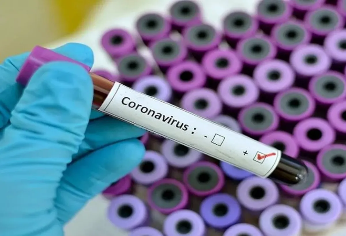 Imagem de raio-x de pulmão com danos pós-Covid-19 grave