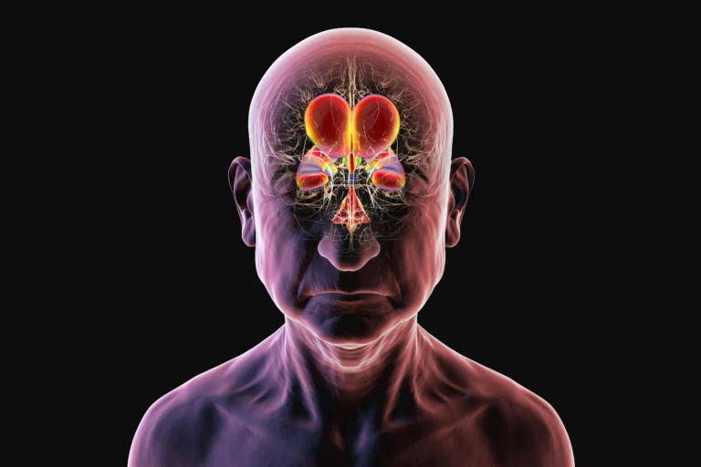 Mãos de idoso segurando modelo de cérebro, simbolizando tratamento de HPN