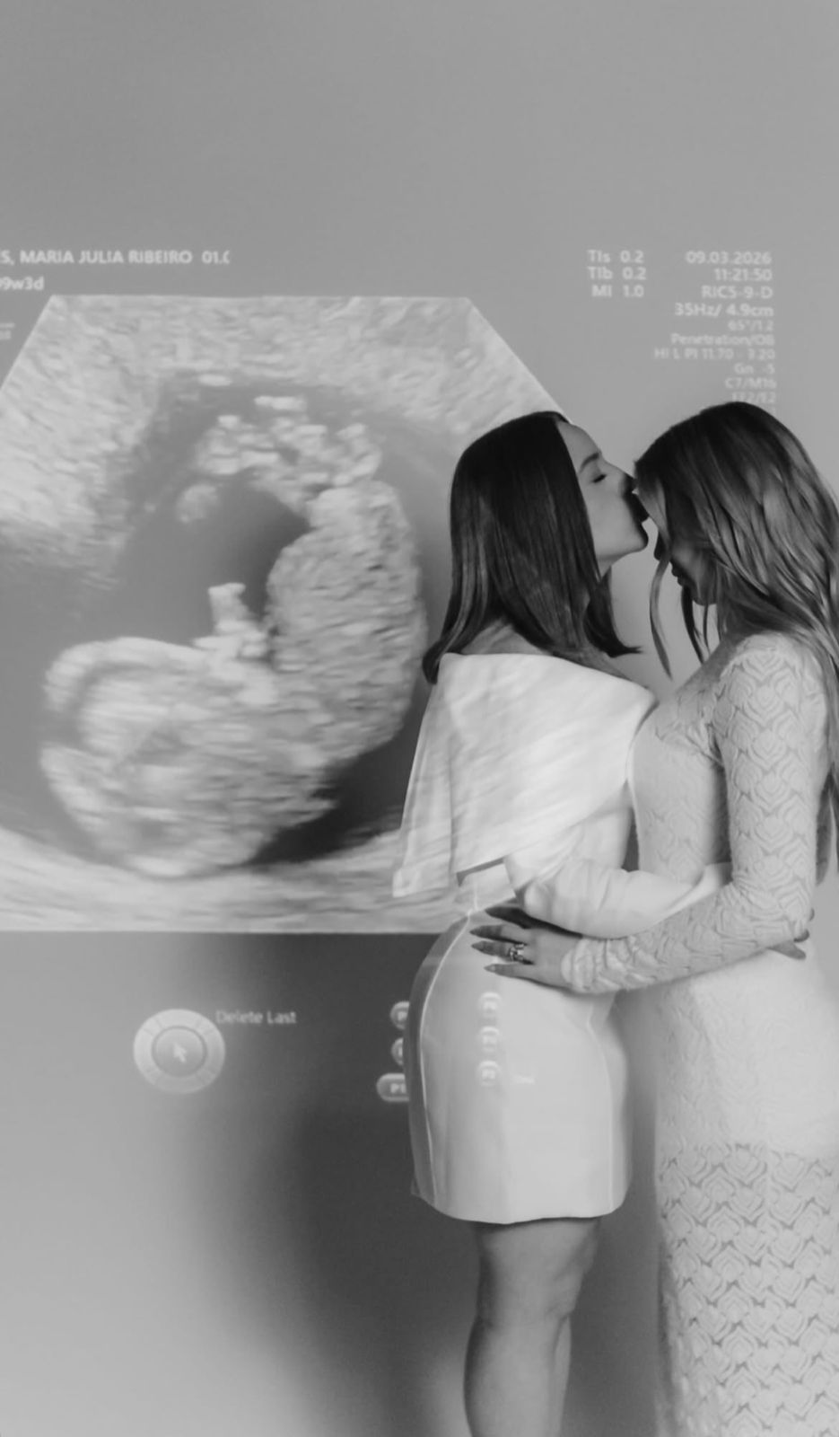 Mari Fernandez e Júlia Ribeiro grávidas e felizes