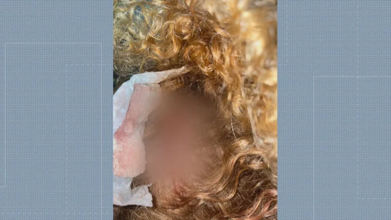 Mulher agredida em Rocha Miranda após recusa de cantada