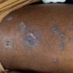 Cela superlotada em presídio de São Paulo com detentos e sinais de falta de higiene, simbolizando as mortes no sistema prisional de SP.