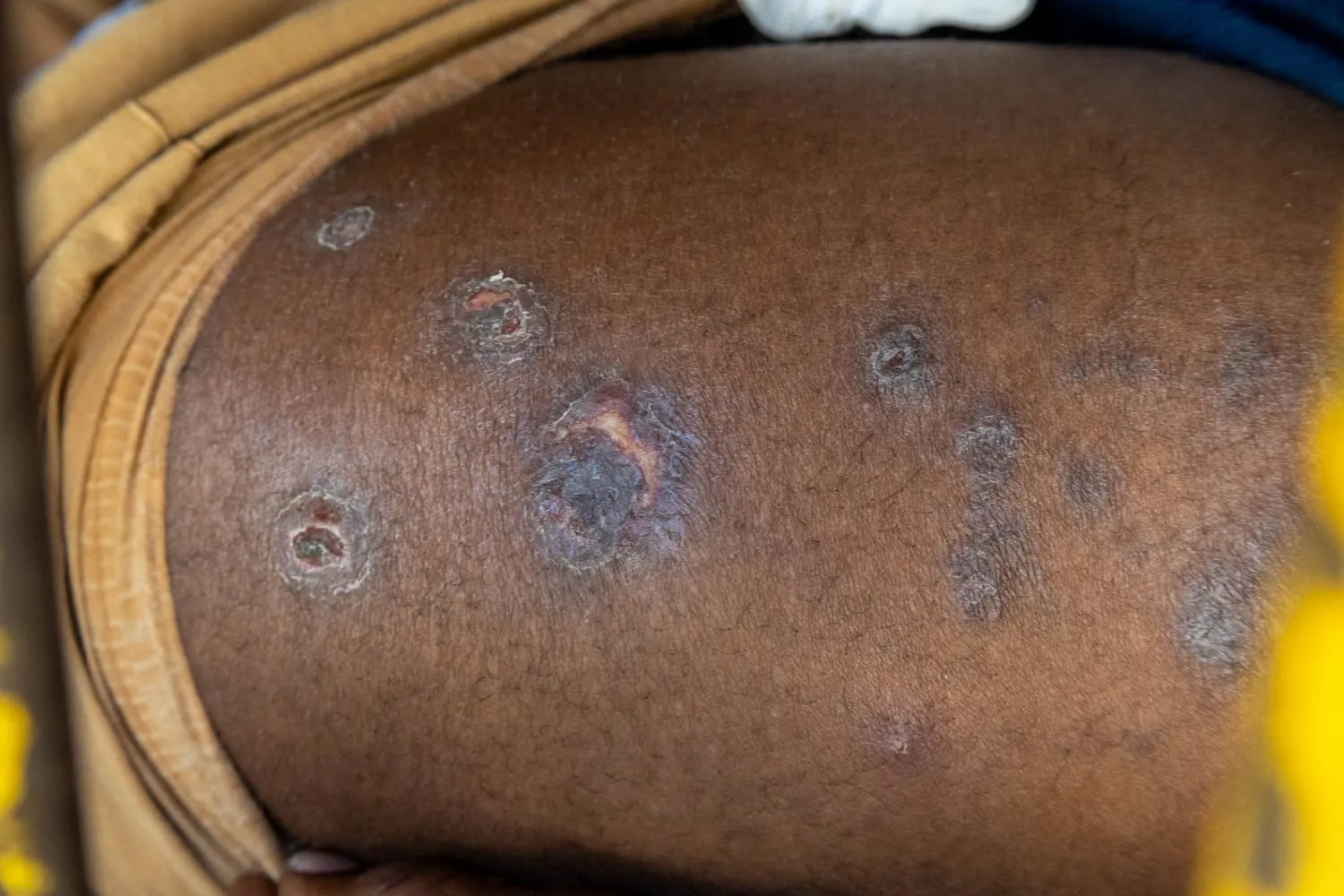 Cela superlotada em presídio de São Paulo com detentos e sinais de falta de higiene, simbolizando as mortes no sistema prisional de SP.