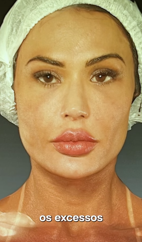 Gracyanne Barbosa rosto natural, Gracyanne sem procedimentos estéticos, musa fitness beleza autêntica, cuidados com a pele Gracyanne