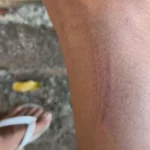 Adolescente agredido em mercado, com ferimentos visíveis, acompanhado do pai em Tanabi