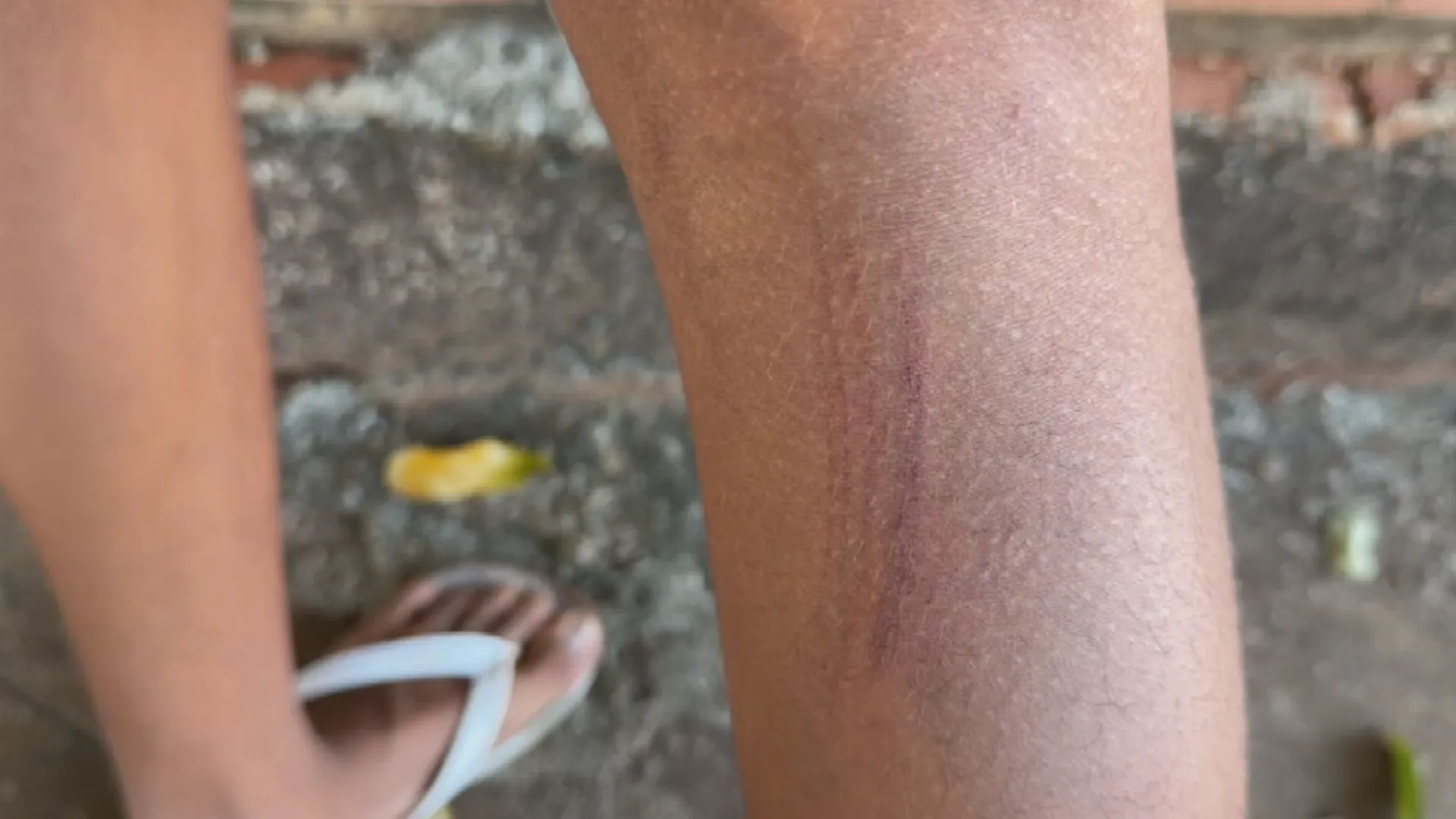 Adolescente agredido em mercado, com ferimentos visíveis, acompanhado do pai em Tanabi