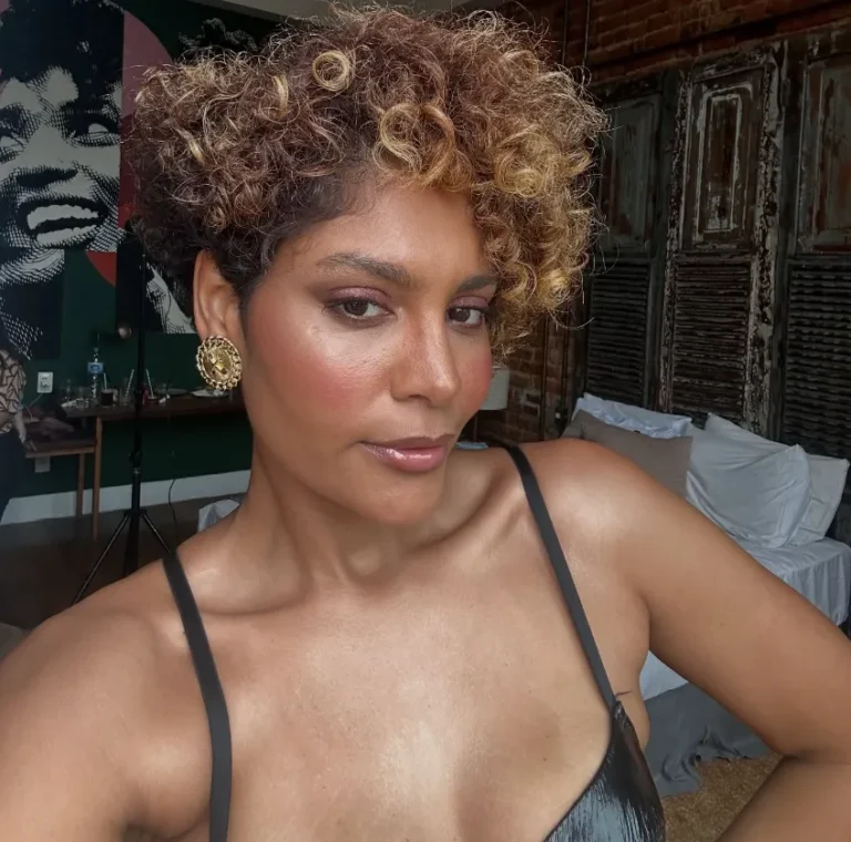 Pernas com lipedema e sinal do garrote