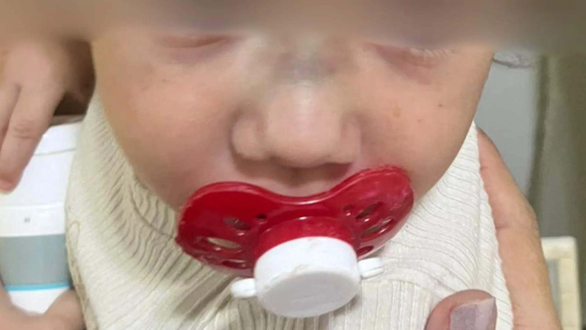 Bebê de 1 ano com nariz machucado e hematomas no rosto após creche em Valentim Gentil