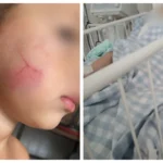 Mãe e bebê na UTI em Sorocaba, caso de agressão