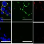 Ultrassom contra vírus, pesquisa USP, tratamento antiviral inovador