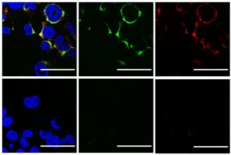 Ultrassom contra vírus, pesquisa USP, tratamento antiviral inovador