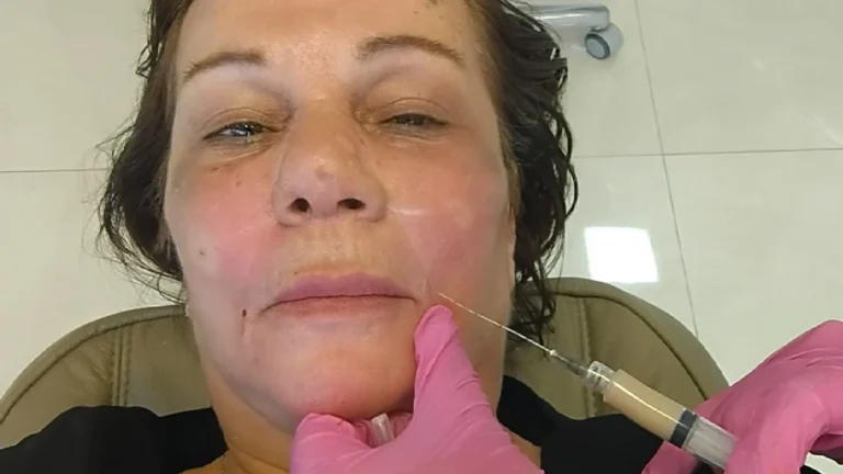 Denúncia formal do Ministério Público sobre procedimento estético irregular.