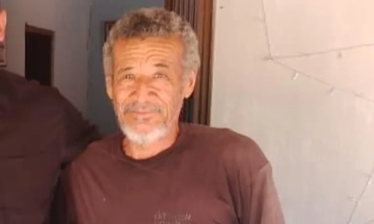 Olho de paciente expressando preocupação após perda de visão em Irecê