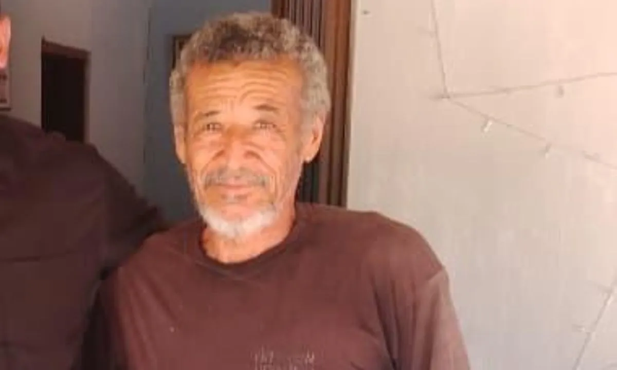 Olho de paciente expressando preocupação após perda de visão em Irecê