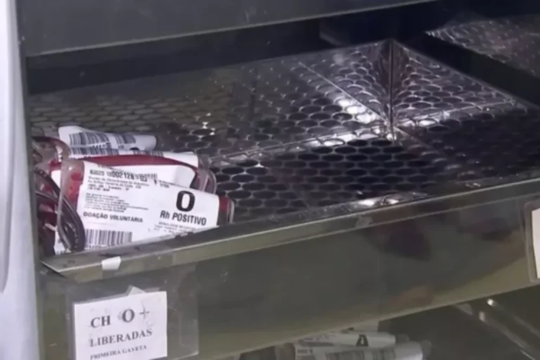 Bolsa de sangue sendo preenchida durante doação no Hemocentro de Araçatuba