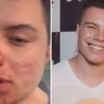 Influencer Clóvis Roberto em recuperação na UTI, após agressão