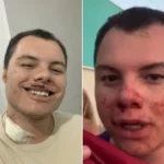 Clóvis Roberto de Leão, influenciador agredido, em recuperação