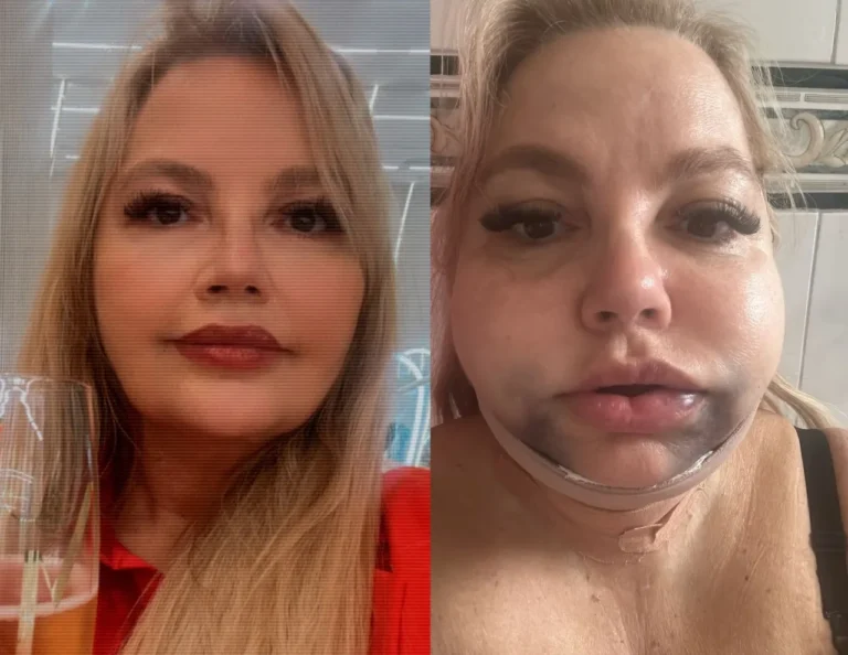 Tornozeleira eletrônica, tornozeleira dentista, monitoramento judicial, justiça, dentista proibida, lesão corporal, harmonização facial, Rio de Janeiro