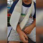 Janela quebrada creche Votorantim, acidente infantil, segurança escolar