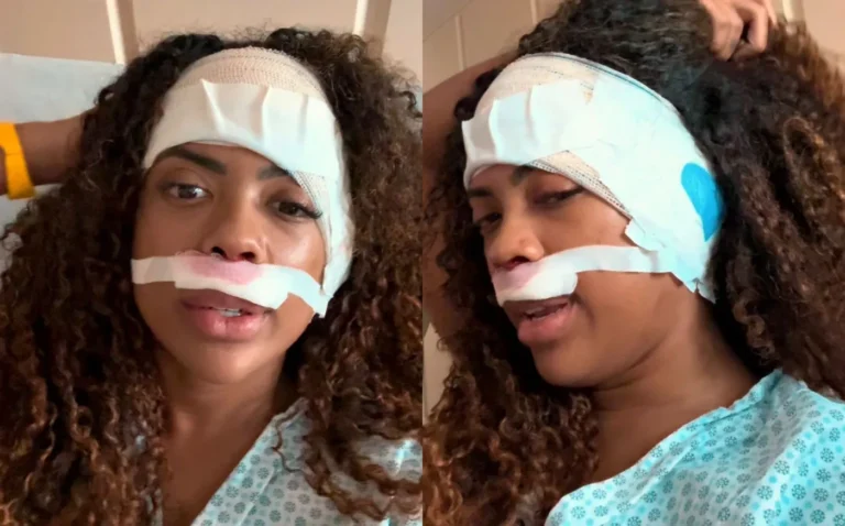 Marvvila cantando no palco após cirurgia de ouvido