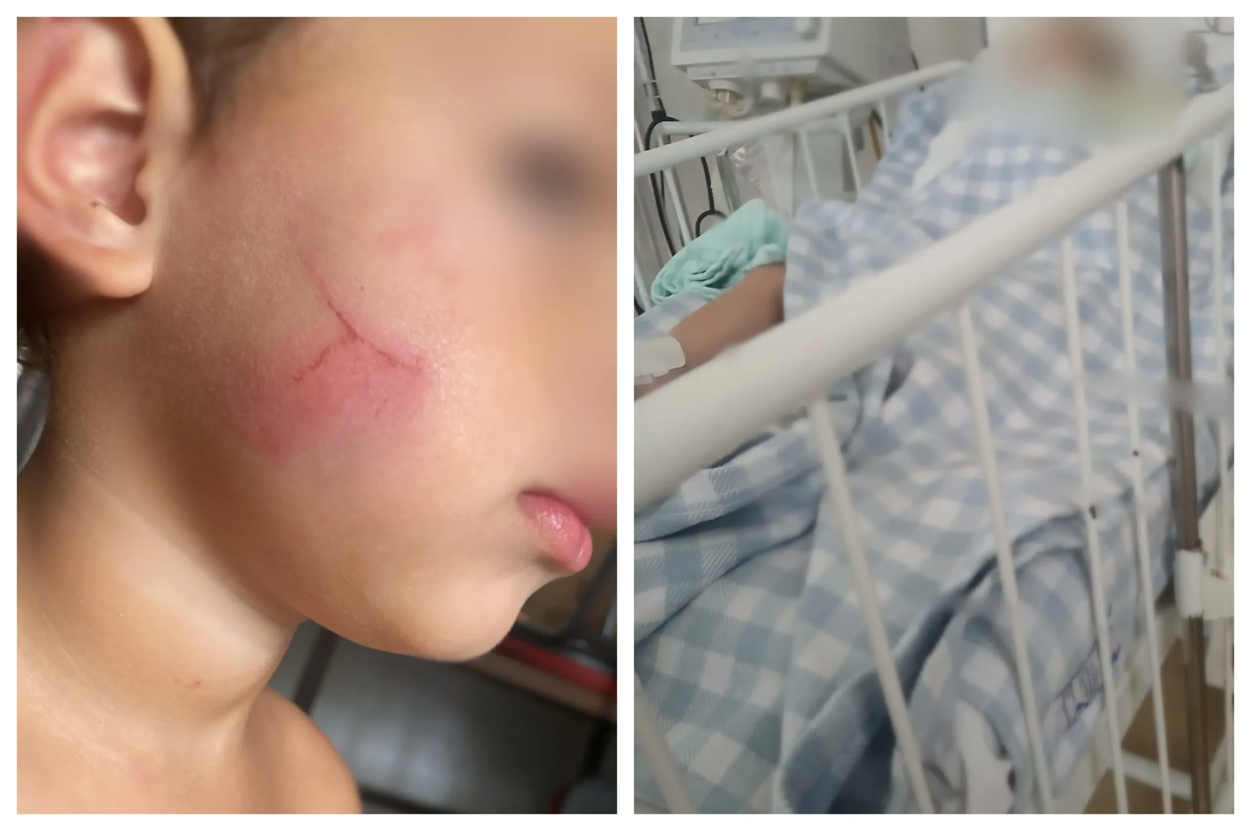 Bebê internado em UTI após suspeita de agressão por babá em Sorocaba