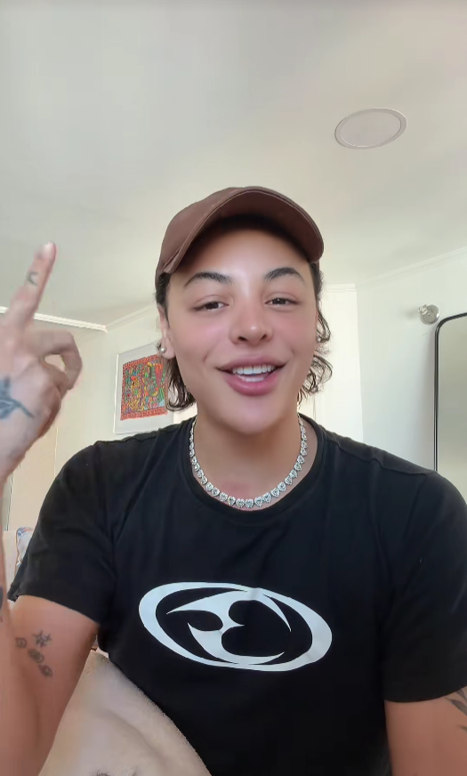 Pabllo Vittar com novo visual após rinoplastia