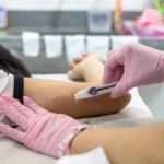 Implanon no SUS Presidente Prudente, aplicação de implante contraceptivo, método contraceptivo gratuito