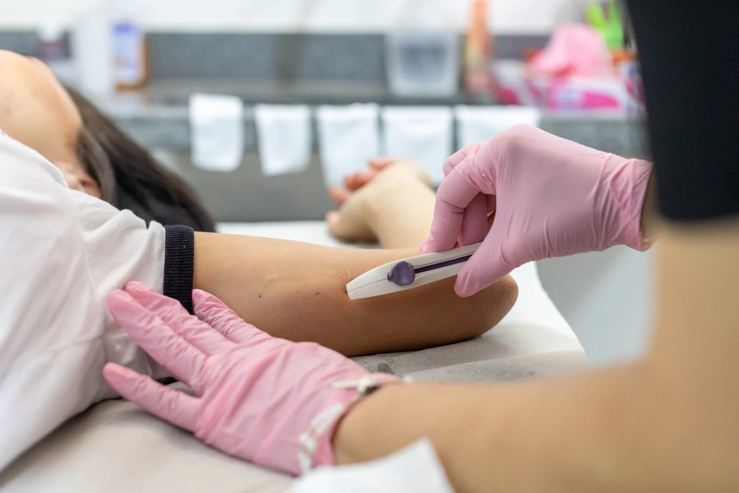 Implanon no SUS Presidente Prudente, aplicação de implante contraceptivo, método contraceptivo gratuito