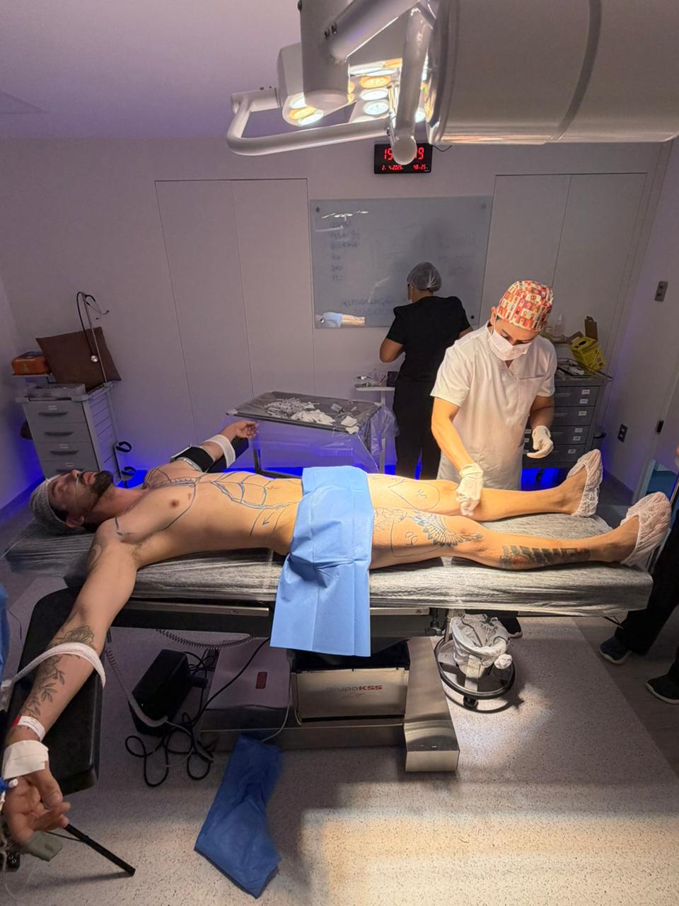 Rico Melquiades sorrindo após lipoaspiração para contorno corporal