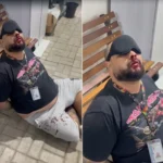 Técnico de enfermagem autista, Jadson Freire de Mendonça, com tapa-olho, em UPA, após denúncia de agressão.