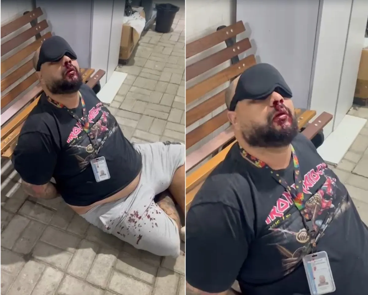 Técnico de enfermagem autista, Jadson Freire de Mendonça, com tapa-olho, em UPA, após denúncia de agressão.