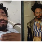 Diego Summer ferido após ataque homofóbico em SP