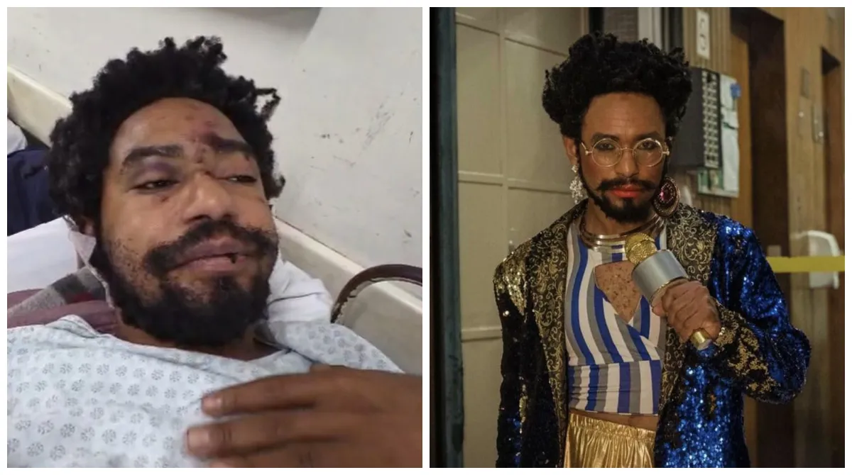 Diego Summer ferido após ataque homofóbico em SP