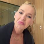 Influenciadora Virginia Fonseca com médico, discutindo tratamento para alopecia areata e saúde capilar.